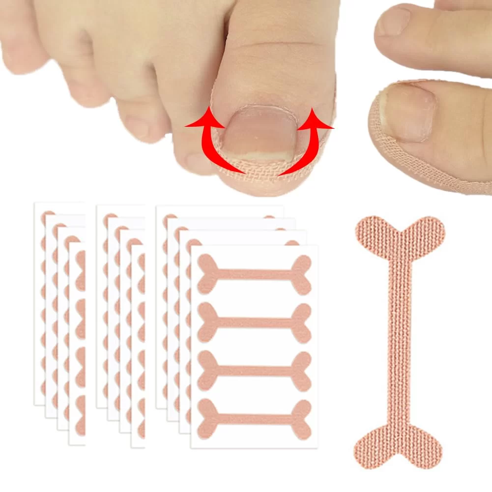 Nail Corrector Stickers » cartech.tech